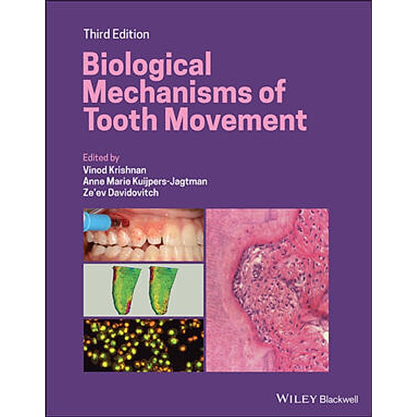 Biological Mechanisms of Tooth Movement, Vinod Krishnan, Anne Marie Kuijpers-Jagtman, Ze'ev Davidovitch