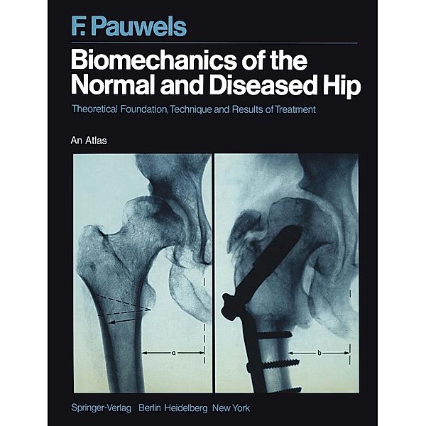 Biomechanics of the Normal and Diseased Hip, Friedrich Pauwels