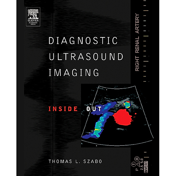 Biomedical Engineering: Diagnostic Ultrasound Imaging: Inside Out, Thomas L. Szabo