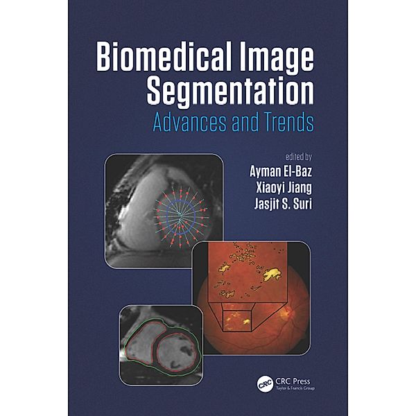 Biomedical Image Segmentation