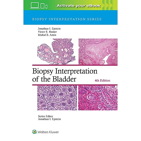 Biopsy Interpretation of the Bladder, Jonathan I. Epstein, Victor E. Reuter, Mahul B. Amin