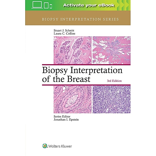 Biopsy Interpretation of the Breast (Biopsy Interpretation Series), Stuart Schnitt, Laura C. Collins