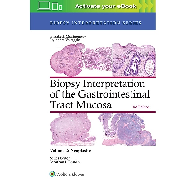 Biopsy Interpretation of the Gastrointestinal Tract Mucosa: Volume 2: Neoplastic, Elizabeth A. Montgomery, Lysandra Voltaggio