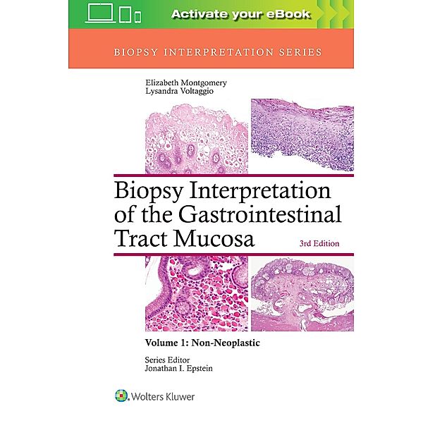 Biopsy Interpretation of the Gastrointestinal Tract Mucosa: Volume 1: Non-Neoplastic, Elizabeth A. Montgomery, Lysandra Voltaggio