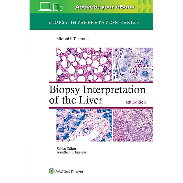 Biopsy Interpretation of the Liver, Michael S. Torbenson