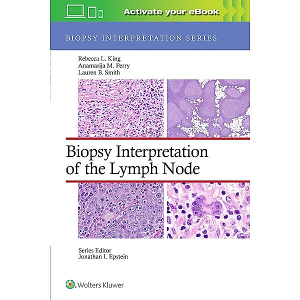 Biopsy Interpretation of the Lymph Node, Rebecca Leigh King, Anamarija M. Perry, Lauren B. Smith