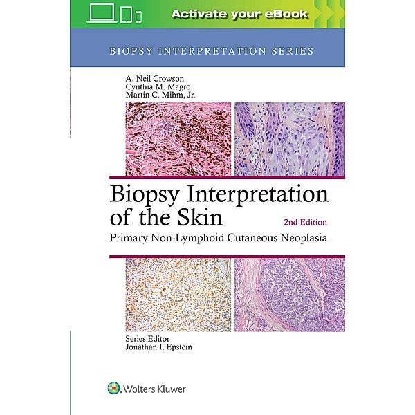 Biopsy Interpretation of the Skin, A. Neil Crowson, Cynthia M. Magro