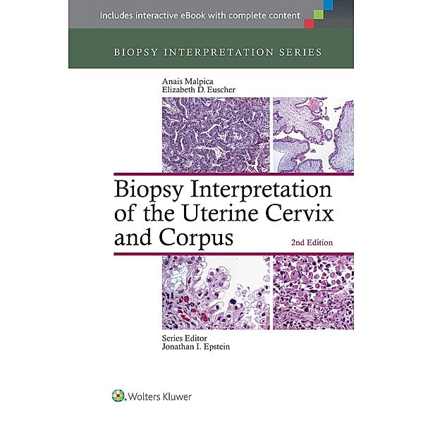 Biopsy Interpretation of the Uterine Cervix and Corpus, Anais Malpica, Elizabeth D. Euscher