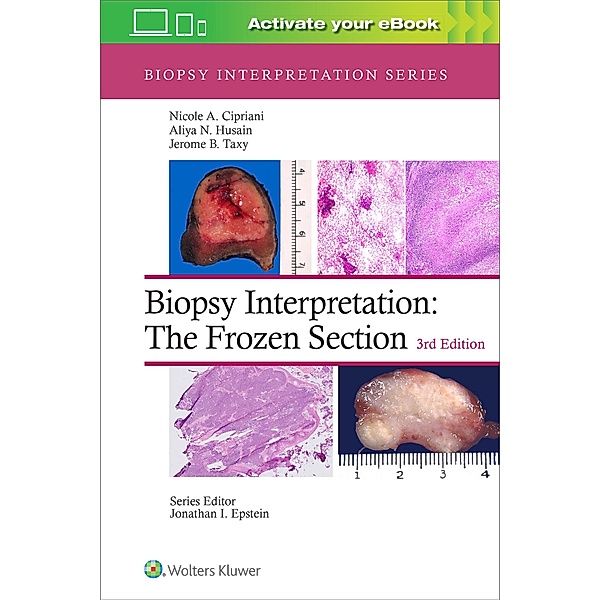 Biopsy Interpretation: The Frozen Section, Nicole A. Cipriani, Aliya N. Husain, Jerome B. Taxy