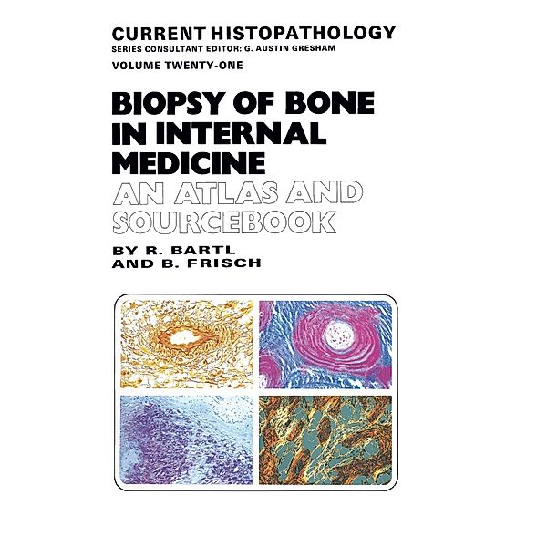 Biopsy of Bone in Internal Medicine: An Atlas and Sourcebook, Reiner Bartl, Bertha Frisch