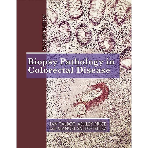 Biopsy Pathology in Colorectal Disease, 2Ed, Ian Talbot, Ashley Price, Manuel Salto-Tellez