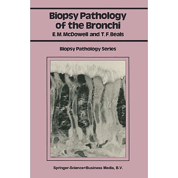 Biopsy Pathology of the Bronchi / Biopsy Pathology Series, Elizabeth M. McDowell, Theodore F. Beals