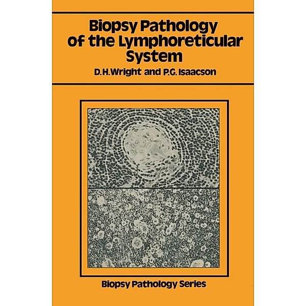 Biopsy Pathology of the Lymphoreticular System, Dennis H. Wright, Peter G. Isaacson