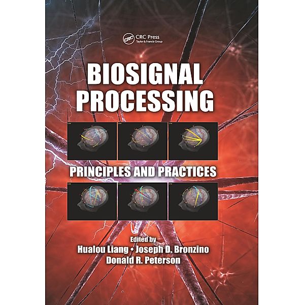 Biosignal Processing