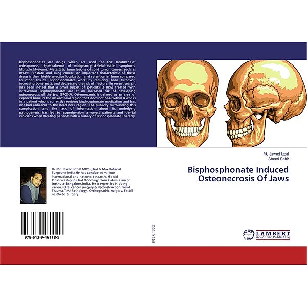 Bisphosphonate Induced Osteonecrosis Of Jaws, Md.Jawed Iqbal, Sheeri Sabir