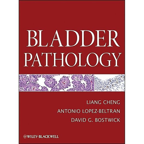 Bladder Pathology, Liang Cheng, Antonio Lopez-Beltran, David G Bostwick