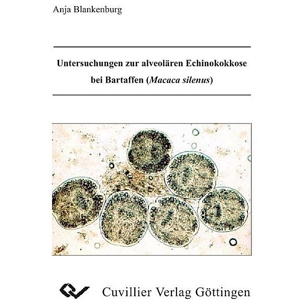 Blankenburg, A: Untersuchungen zur alveolären Echinokokkose, Anja Blankenburg