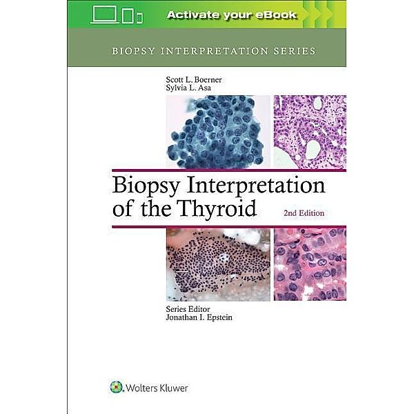 Boerner, S: Biopsy Interpretation of the Thyroid, Scott L. Boerner, Sylvia L. Asa