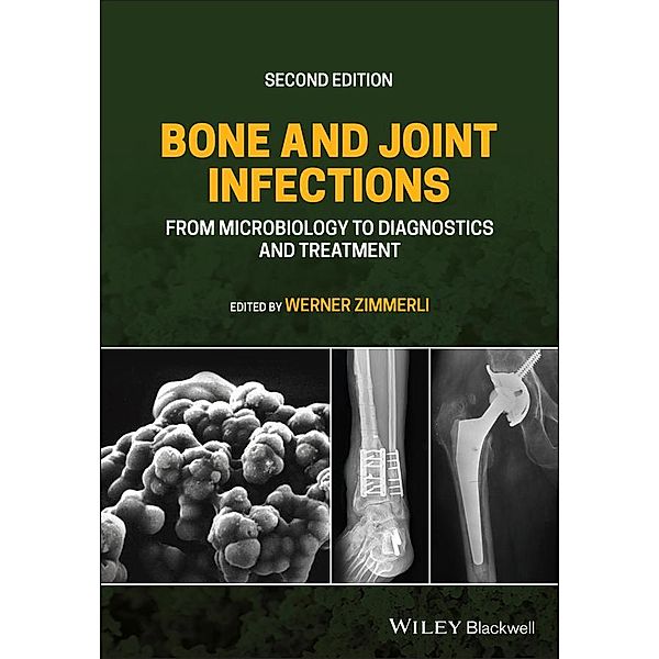 Bone and Joint Infections