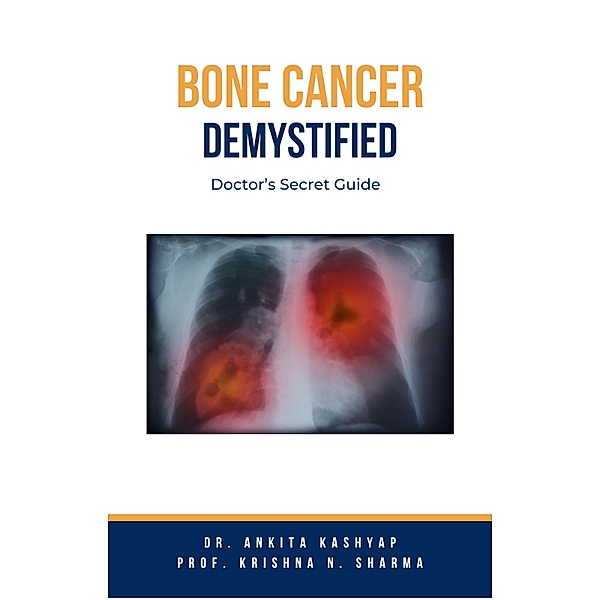 Bone Cancer Demystified: Doctor's Secret Guide, Ankita Kashyap, Krishna N. Sharma