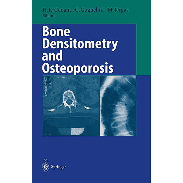 Bone Densitometry and Osteoporosis