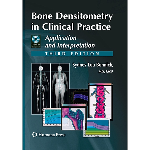Bone Densitometry in Clinical Practice, Sydney Lou Bonnick
