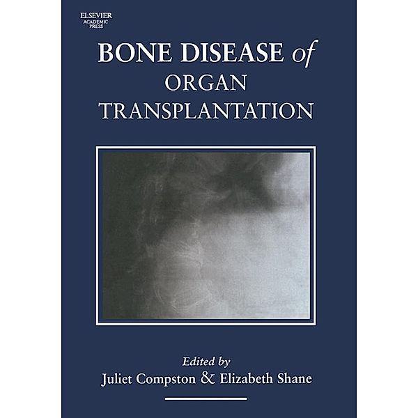 Bone Disease of Organ Transplantation