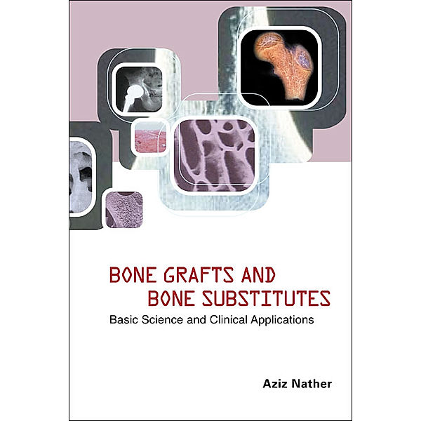Bone Grafts And Bone Substitutes: Basic Science And Clinical Applications