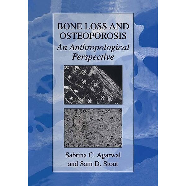 Bone Loss and Osteoporosis