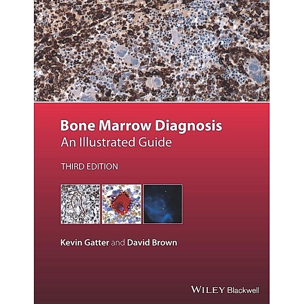 Bone Marrow Diagnosis, Kevin Gatter, David Brown