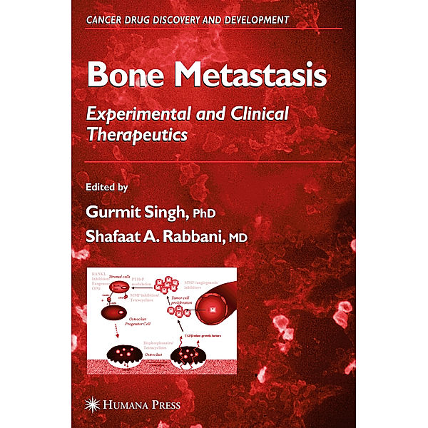 Bone Metastasis