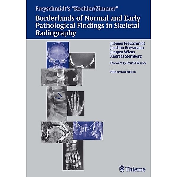 Borderlands of Normal and Early Pathologic Findings in Skeletal Radiograph, Jürgen Wiens, Andreas Sternberg