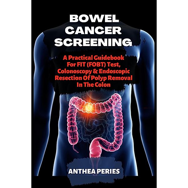 Bowel Cancer Screening: A Practical Guidebook For FIT (FOBT) Test, Colonoscopy & Endoscopic Resection Of Polyp Removal In The Colon (Colon and Rectal) / Colon and Rectal, Anthea Peries