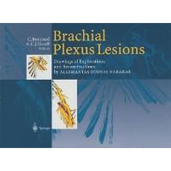 Brachial Plexus Lesions