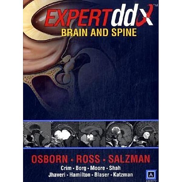 Brain and Spine, Anne G Osborn, Jeff Ross, Julia Crim, Karen L Salzman, Susan I Blaser