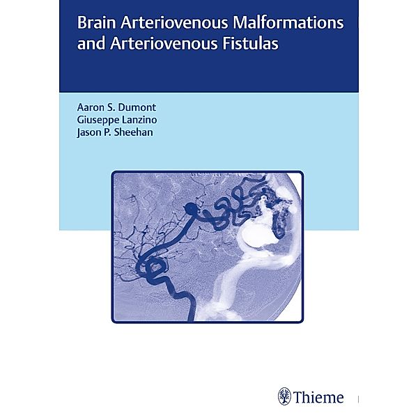 Brain Arteriovenous Malformations and Arteriovenous Fistulas