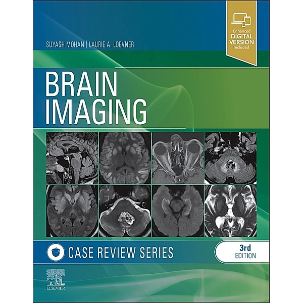 Brain Imaging: Case Review Series, Suyash Mohan, Laurie A. Loevner