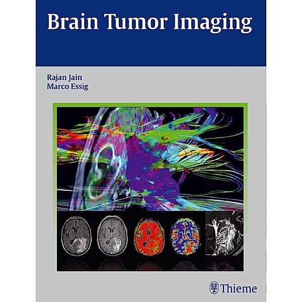 Brain Tumor Imaging, Rajan Jain, Marco Essig