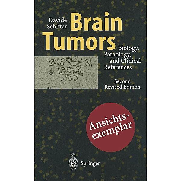 Brain Tumors, Davide Schiffer