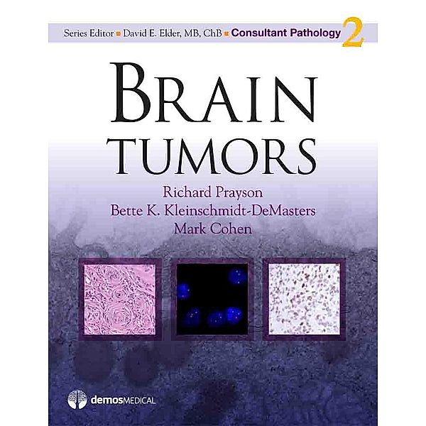 Brain Tumors / Consultant Pathology Bd.Volume 2, Mark Cohen, Bette K. Kleinschmidt-DeMasters, Richard Prayson