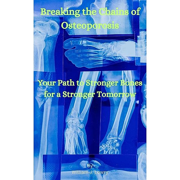 Breaking the Chains of Osteoporosis, William J. Lowry