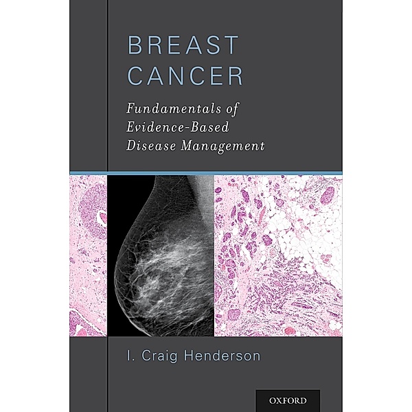 Breast Cancer, I. Craig Henderson