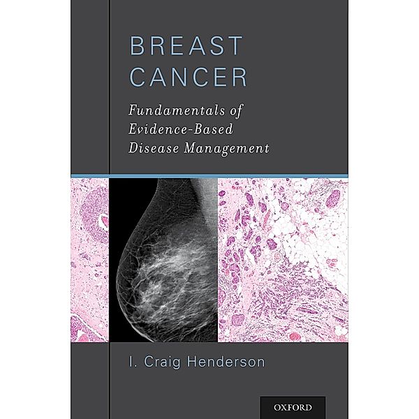 Breast Cancer, I. Craig MD Henderson