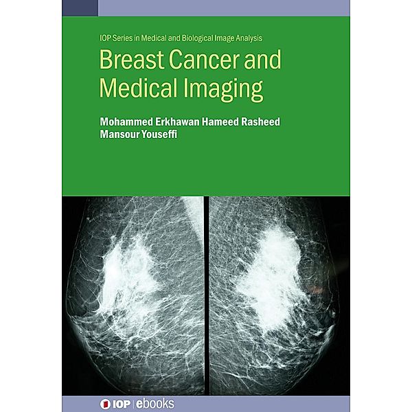Breast Cancer and Medical Imaging, Mohammed Erkhawan Hameed Rasheed, Mansour Youseffi
