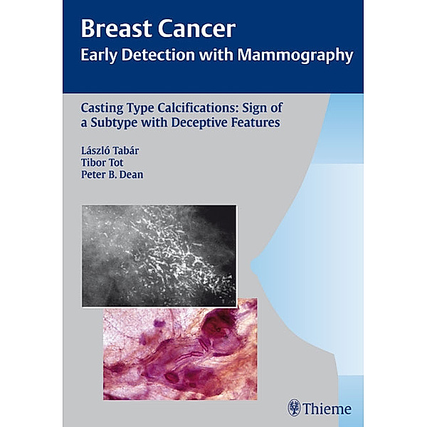 Breast Cancer / Casting Type Calcifications: Sign of a Subtype with Deceptive Features, Laszlo Tabar, Tibor Tot, Peter B. Dean