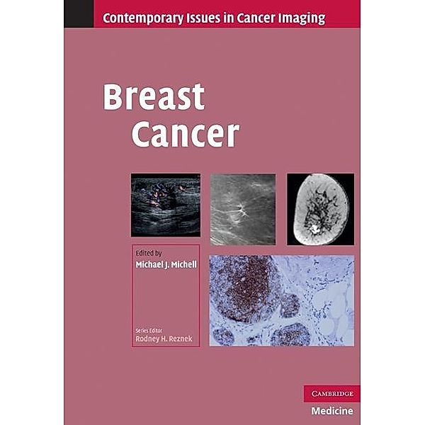 Breast Cancer / Contemporary Issues in Cancer Imaging