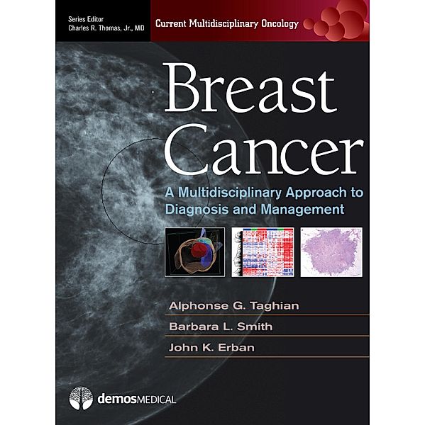 Breast Cancer / Current Multidisciplinary Oncology
