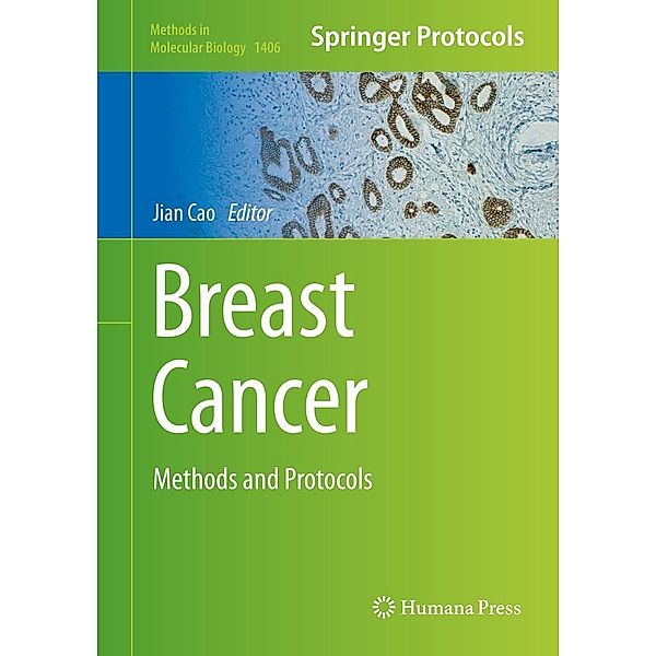 Breast Cancer / Methods in Molecular Biology Bd.1406