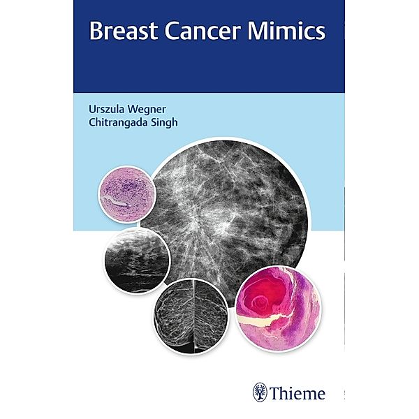 Breast Cancer Mimics, Urszula Wegner, Chitrangada Singh
