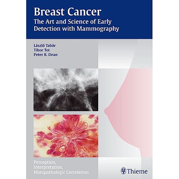 Breast Cancer - The Art and Science of Early Detection with Mammography / Tabar Mammo, Laszlo Tabar, Tibor Tot, Peter B. Dean